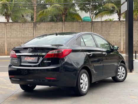 HYUNDAI HB 20 Sedan , Foto 13