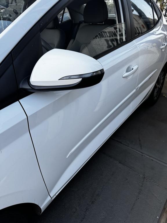 HYUNDAI HB 20 Sedan - Foto