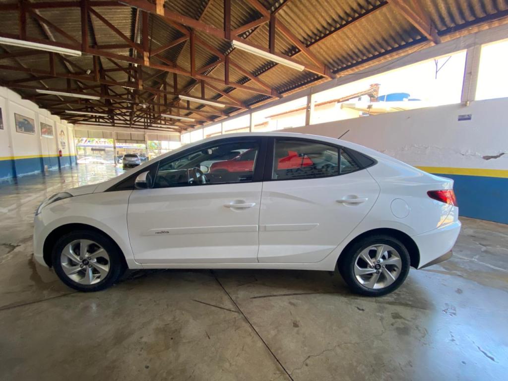 HYUNDAI HB 20 Sedan - Foto