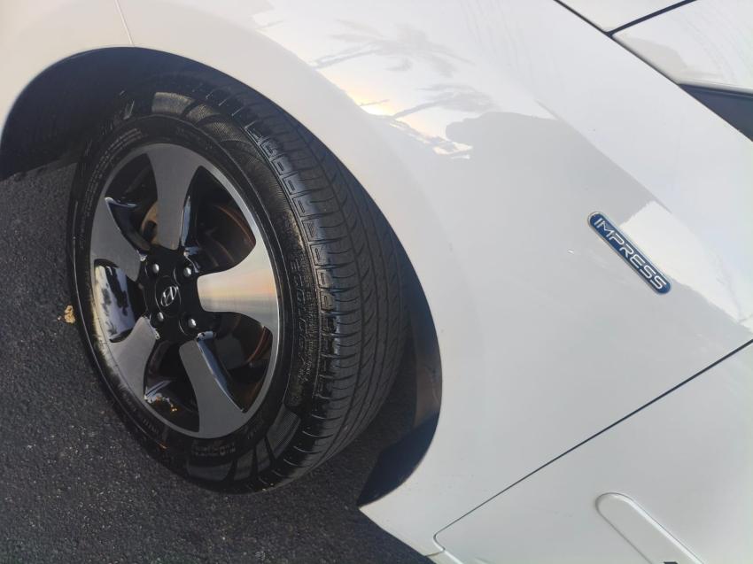 HYUNDAI HB 20 Sedan - Foto