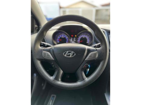 HYUNDAI HB 20 Hatch , Foto 5
